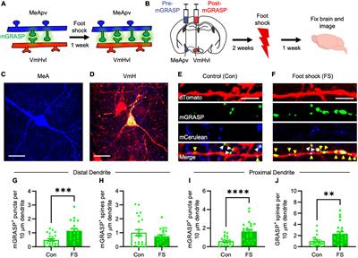 Visualizing traumatic stress-induced structural plasticity in a medial amygdala pathway using mGRASP